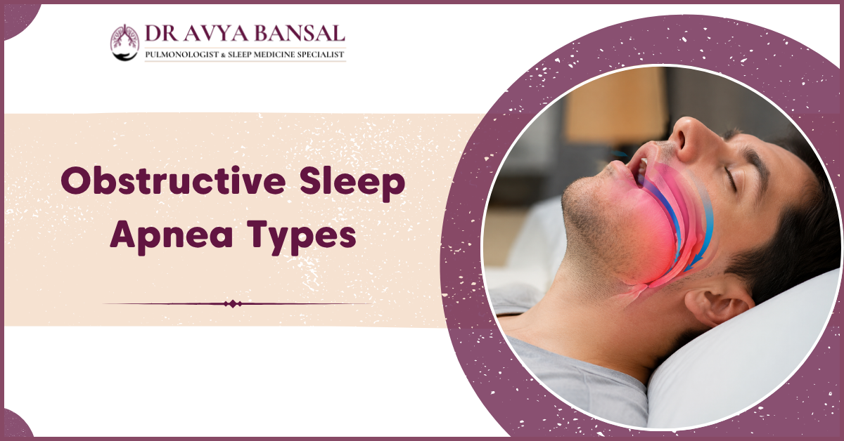 Obstructive Sleep Apnea Types