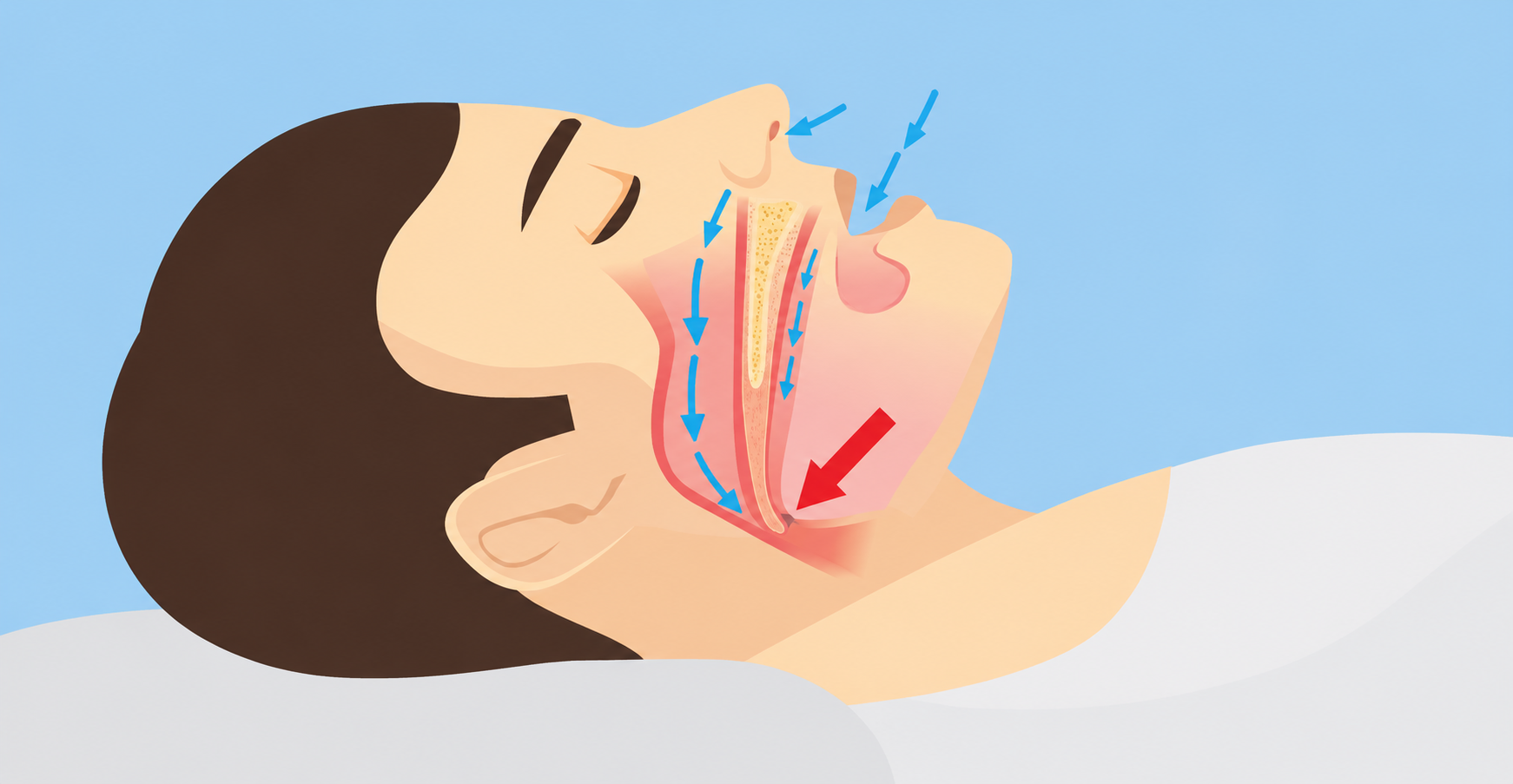 Causes of Sleep Apnea